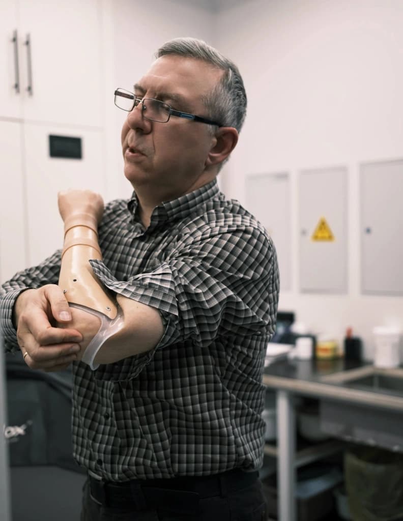 Удобный протез для опытного пользователя Евгения